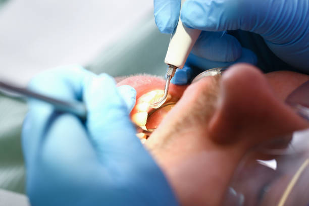 Dentist for Dental Trauma in FL