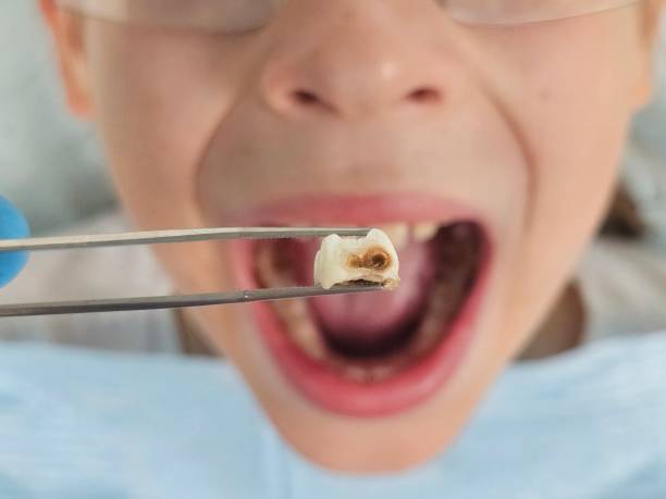Best Emergency Pediatric Dentist  in St Augustine Beach, FL
