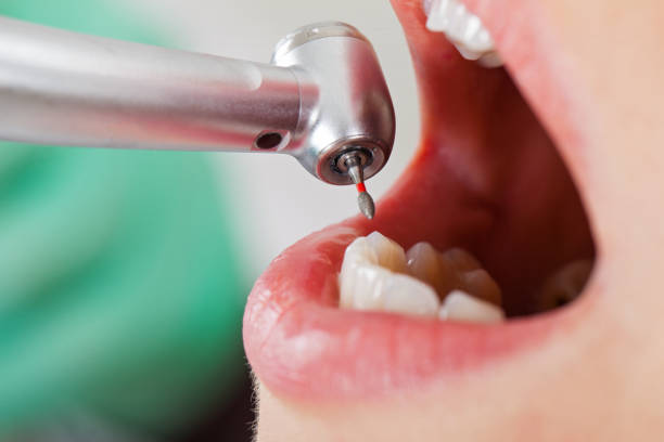 Best Urgent Tooth Repair  in St Augustine Beach, FL